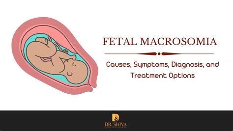 macrossomia fetal - circulacion fetal